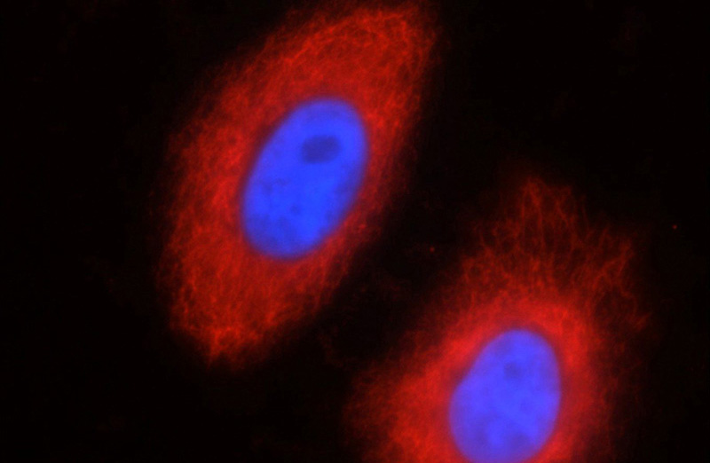 Immunofluorescent analysis of HeLa cells using Catalog No:109800(KRT18 Antibody) at dilution of 1:50 and Rhodamine-Goat anti-Rabbit IgG