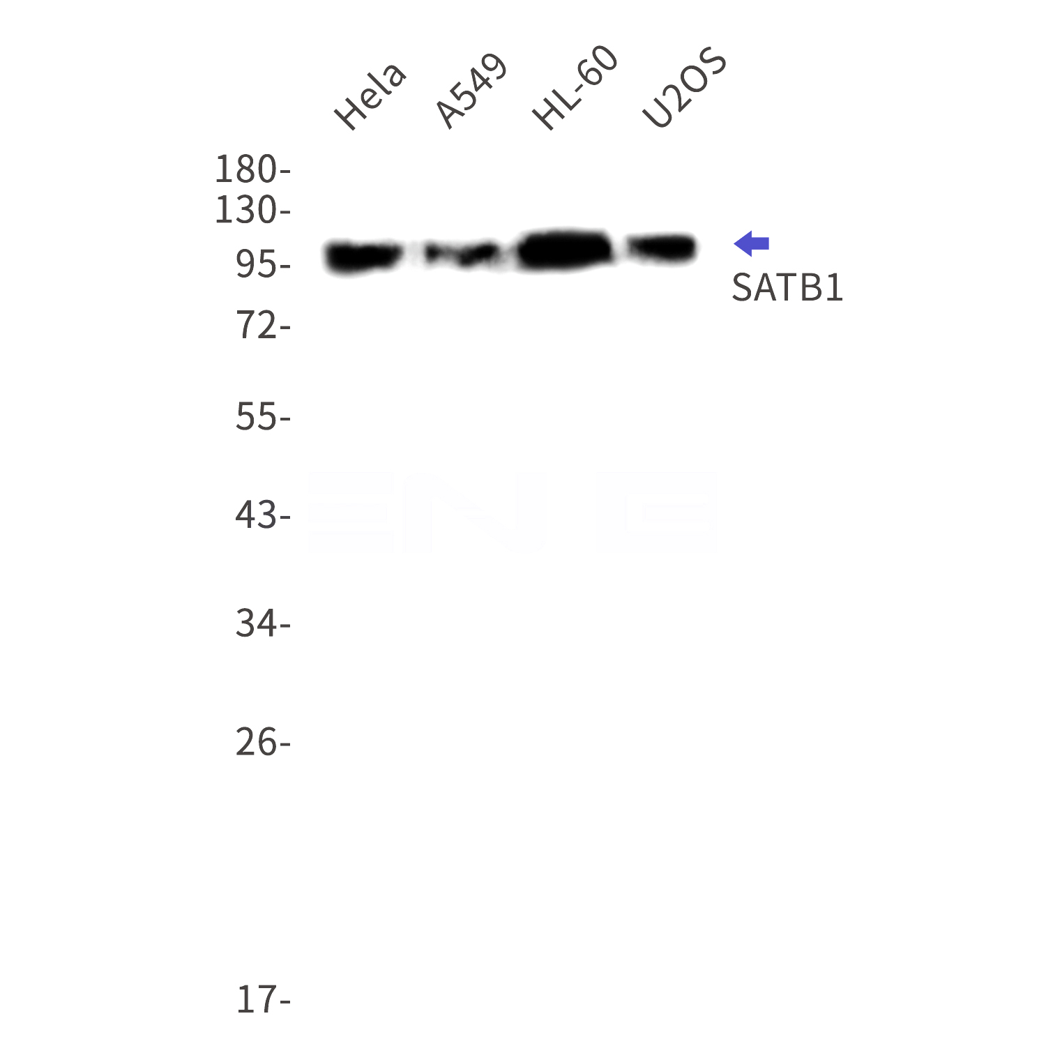 Western blot detection of SATB1 in Hela,A549,HL-60,U2OS cell lysates using SATB1 Rabbit mAb(1:1000 diluted).Predicted band size:86kDa.Observed band size:100kDa.