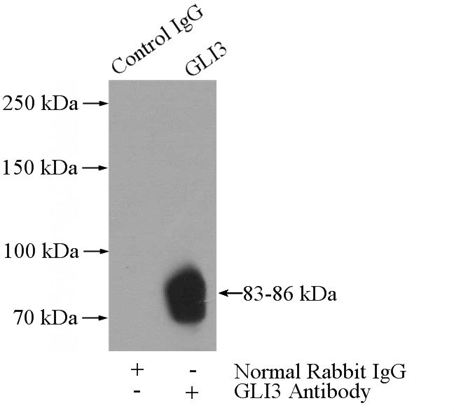 IP Result of anti-GLI3-Specific (IP:Catalog No:111022, 4ug; Detection:Catalog No:111022 1:300) with mouse lung tissue lysate 4000ug.