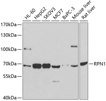 Western blot - RPN1 Polyclonal Antibody 