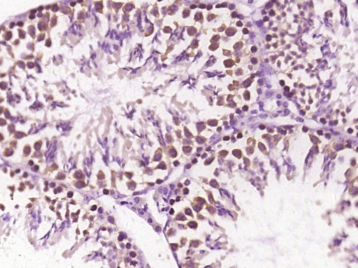 Fig3: Paraformaldehyde-fixed, paraffin embedded (mouse testis tissue); Antigen retrieval by boiling in sodium citrate buffer (pH6.0) for 15min; Block endogenous peroxidase by 3% hydrogen peroxide for 20 minutes; Blocking buffer (normal goat serum) at 37℃ for 30min; Antibody incubation with (CHST3) Polyclonal Antibody, Unconjugated at 1:400 overnight at 4℃, followed by operating according to SP Kit(Rabbit) (sp-0023) instructionsand DAB staining.