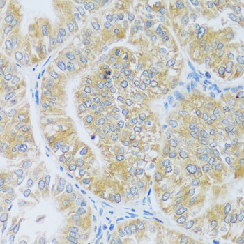 Immunohistochemistry - ASB4 Polyclonal Antibody 