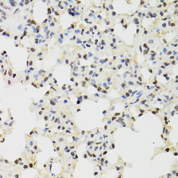 Immunohistochemistry - KDM4A Polyclonal Antibody 