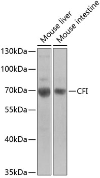 Western blot - CFI Polyclonal Antibody 