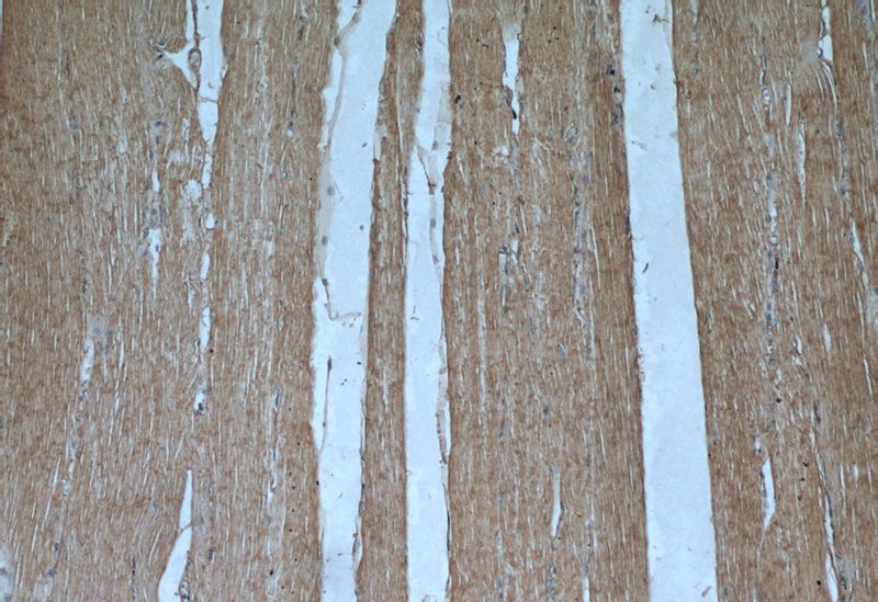 Immunohistochemical of paraffin-embedded human skeletal muscle using Catalog No:108260(ARHGAP10 antibody) at dilution of 1:50 (under 10x lens)