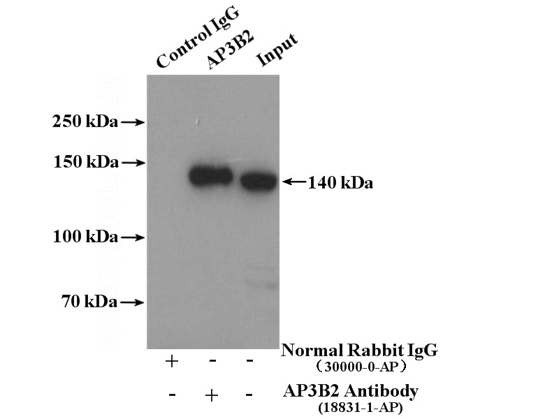 IP Result of anti-AP3B2 (IP:Catalog No:108122, 4ug; Detection:Catalog No:108122 1:500) with mouse brain tissue lysate 3600ug.