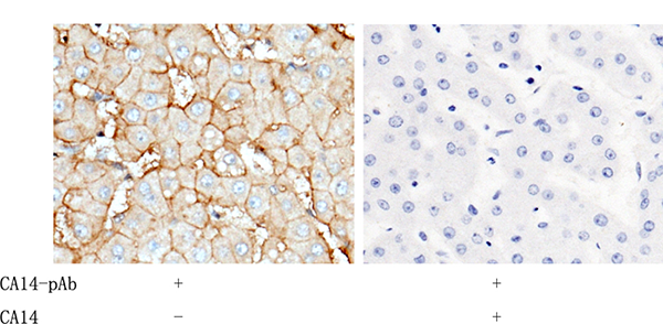 Carbonic Anhydrase XIV / CA14 Antibody, Rabbit PAb, Antigen Affinity Purified, Immunohistochemistry