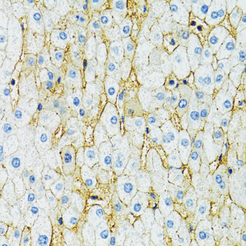 Immunohistochemistry - SLC1A2 Polyclonal Antibody 