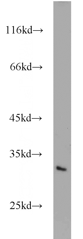 Jurkat cells were subjected to SDS PAGE followed by western blot with Catalog No:112576(MEA1 antibody) at dilution of 1:500