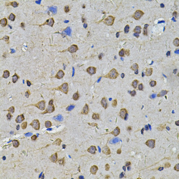 Immunohistochemistry - N6AMT1 Polyclonal Antibody 