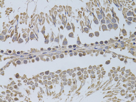 Immunohistochemistry - P2RY2 Polyclonal Antibody 