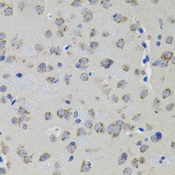 Immunohistochemistry - ACE Polyclonal Antibody 