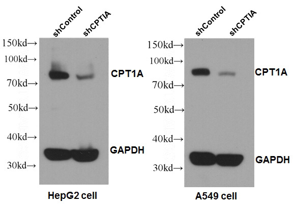 WB results of CPT1A antibody (1:1000) with shCPT1A-A549 and shCPT1A-HepG2 cells. shControl-A549 and shControl-HepG2 as positive control.