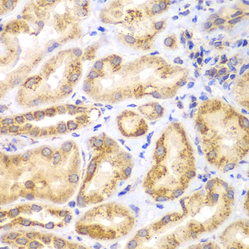 Immunohistochemistry - EYA3 Polyclonal Antibody 