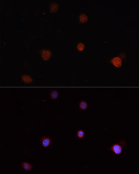 Immunofluorescence - NLRC4 Polyclonal Antibody 