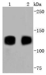 Fig1: Western blot analysis of TrkA+B+C on different lysates using anti-TrkA+B+C antibody at 1/1,000 dilution.; Positive control:; Lane 1: Rat brain; Lane 2: Mouse brain