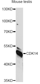 Western blot - CDK14 Polyclonal Antibody 
