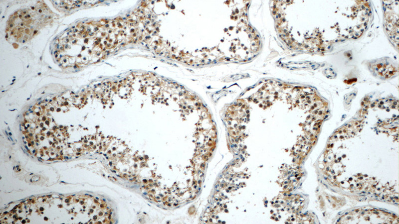 Immunohistochemistry of paraffin-embedded human testis tissue slide using Catalog No:114207(PRMT5 Antibody) at dilution of 1:50 (under 10x lens)