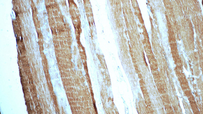 Immunohistochemistry of paraffin-embedded human skeletal muscle tissue slide using Catalog No:112927(MYH1 Antibody) at dilution of 1:50 (under 10x lens)