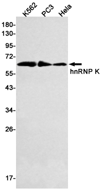Western blot detection of hnRNP K in K562,PC3,Hela cell lysates using hnRNP K Rabbit mAb(1:500 diluted).Predicted band size:51kDa.Observed band size:62kDa.