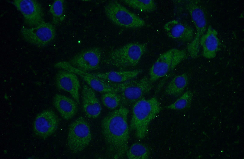 Immunofluorescent analysis of A431 cells using Catalog No:110231(ELOVL4 Antibody) at dilution of 1:25 and Alexa Fluor 488-congugated AffiniPure Goat Anti-Rabbit IgG(H+L)
