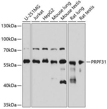 Western blot - PRPF31 Polyclonal Antibody 