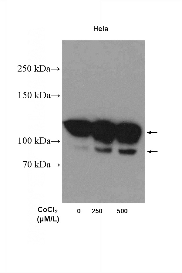 Cobalt Chloride treated HeLa cells were subjected to SDS PAGE followed by western blot with Catalog No:113588(PARP1 Antibody) at dilution of 1:1000