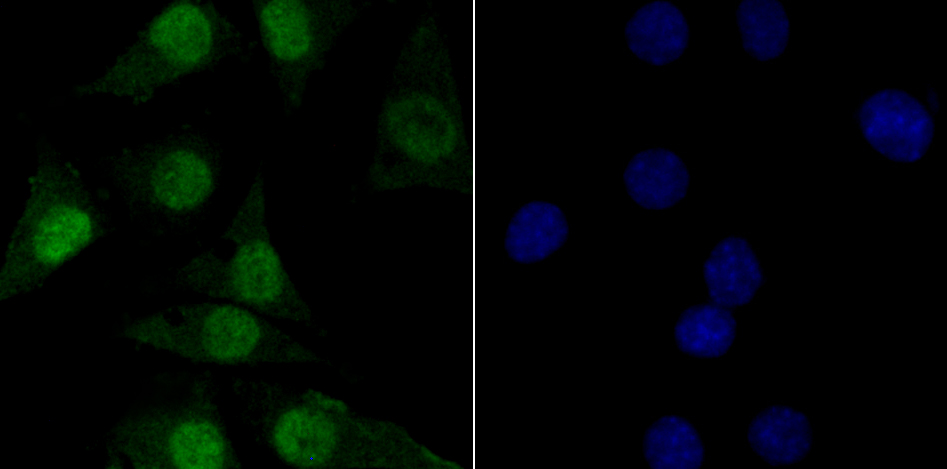 Fig3:; ICC staining of TNPO3 in SH-SY5Y cells (green). Formalin fixed cells were permeabilized with 0.1% Triton X-100 in TBS for 10 minutes at room temperature and blocked with 1% Blocker BSA for 15 minutes at room temperature. Cells were probed with the primary antibody ( 1/50) for 1 hour at room temperature, washed with PBS. Alexa Fluor®488 Goat anti-Rabbit IgG was used as the secondary antibody at 1/1,000 dilution. The nuclear counter stain is DAPI (blue).