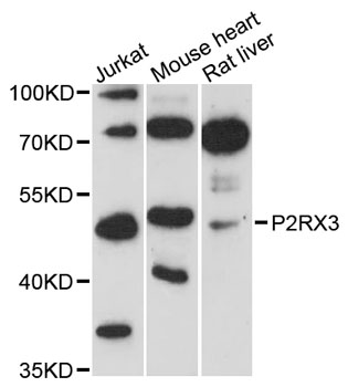 Western blot - P2RX3 Polyclonal Antibody 