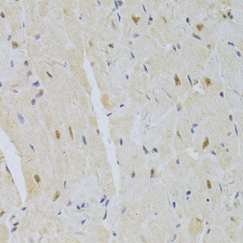 Immunohistochemistry - SNRPA Polyclonal Antibody 
