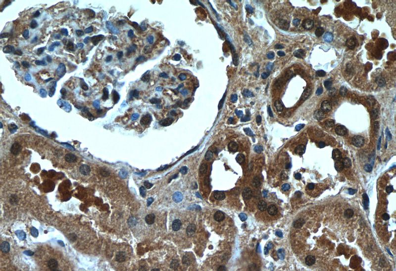 Immunohistochemistry of paraffin-embedded human kidney tissue slide using Catalog No:109650(CXorf26 Antibody) at dilution of 1:50 (under 40x lens)
