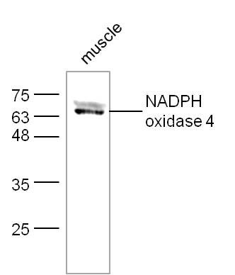 Fig8: Sample:; muscle (Mouse) Lysate at 40 ug; Primary: Anti-NADPH oxidase 4 at 1/300 dilution; Secondary: IRDye800CW Goat Anti-Rabbit IgG at 1/20000 dilution; Predicted band size: 64 kD; Observed band size: 64 kD