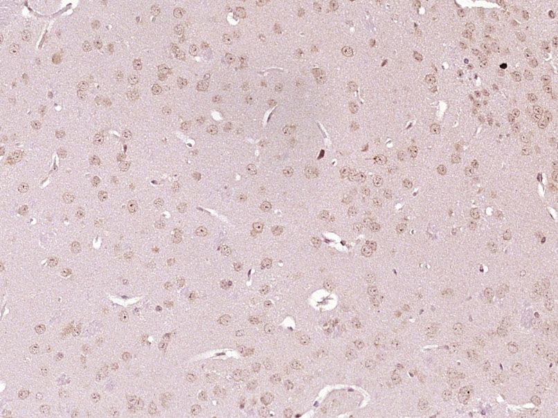 Fig1: Paraformaldehyde-fixed, paraffin embedded (Mouse brain); Antigen retrieval by boiling in sodium citrate buffer (pH6.0) for 15min; Block endogenous peroxidase by 3% hydrogen peroxide for 20 minutes; Blocking buffer (normal goat serum) at 37℃ for 30min; Antibody incubation with (Deltex 1) Polyclonal Antibody, Unconjugated at 1:400 overnight at 4℃, followed by operating according to SP Kit(Rabbit) (sp-0023) instructionsand DAB staining.