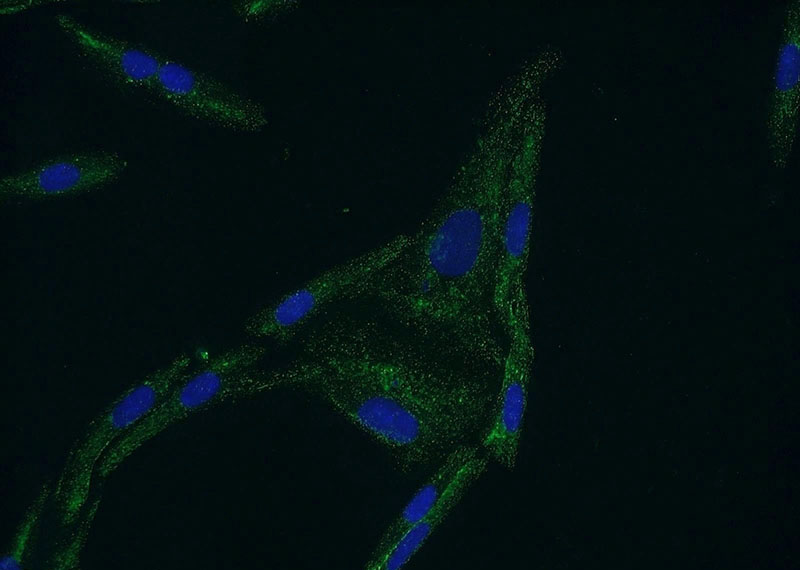 Immunofluorescent analysis of SKOV-3 cells using Catalog No:109680(CYP11B2 Antibody) at dilution of 1:50 and Alexa Fluor 488-congugated AffiniPure Goat Anti-Rabbit IgG(H+L)