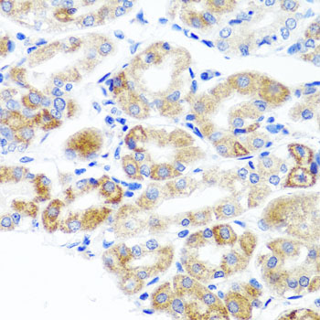 Immunohistochemistry - DLG1 Polyclonal Antibody 