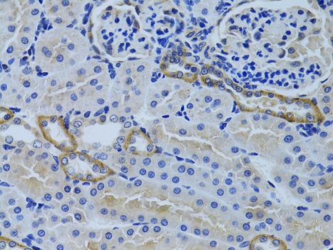 Immunohistochemistry - FHL2 Polyclonal Antibody 