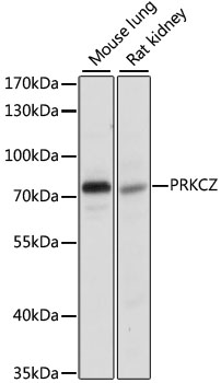 Western blot - PRKCZ Polyclonal Antibody 