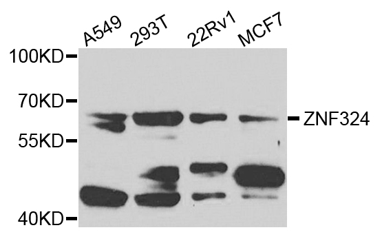Western blot - ZNF324 Polyclonal Antibody 