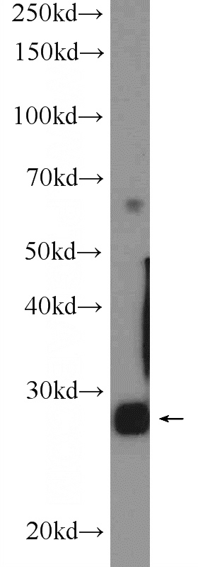 mouse testis tissue were subjected to SDS PAGE followed by western blot with Catalog No:113776(PGAM2 Antibody) at dilution of 1:600