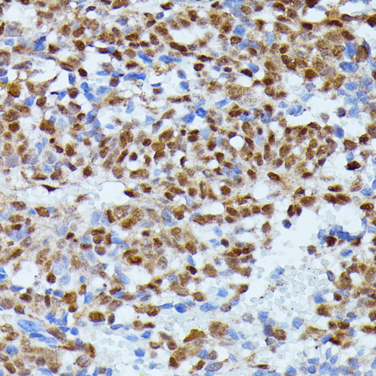 Immunohistochemistry - ID2 Polyclonal Antibody 