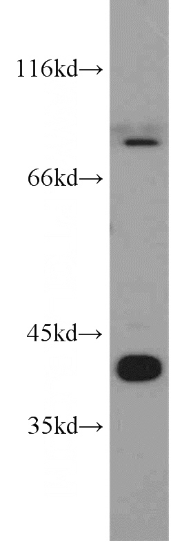 K-562 cells were subjected to SDS PAGE followed by western blot with Catalog No:115206(SERPINB9 antibody) at dilution of 1:1500
