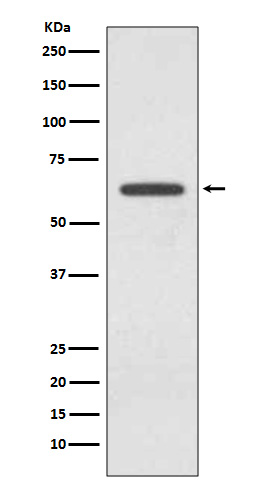Western blot analysis of Glutaminase expression in 293T cell lysate.