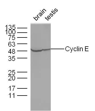 Fig5: Sample:; Brain(Mouse) Lysate at 40 ug; Testis(Mouse) Lysate at 40 ug; Primary: Anti-Cyclin E at 1/300 dilution; Secondary: IRDye800CW Goat Anti-Rabbit IgG at 1/10000 dilution; Predicted band size: 45 kD; Observed band size: 48 kD