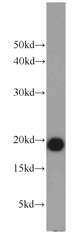 Raji cells were subjected to SDS PAGE followed by western blot with Catalog No:113006(MZB1 antibody) at dilution of 1:1000