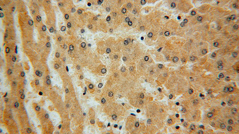 Immunohistochemical of paraffin-embedded human liver using Catalog No:112102(KLHL3 antibody) at dilution of 1:100 (under 40x lens)