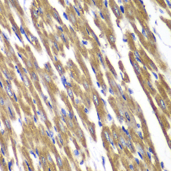 Immunohistochemistry - SDHA Polyclonal Antibody 