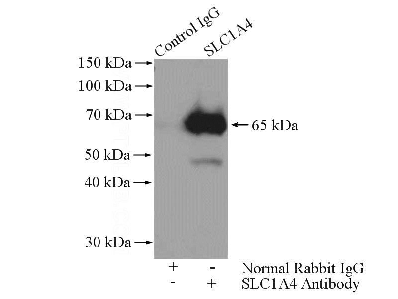 IP Result of anti-SLC1A4 (IP:Catalog No:115309, 4ug; Detection:Catalog No:115309 1:1000) with mouse brain tissue lysate 4000ug.