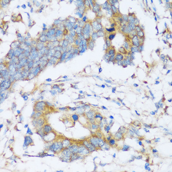 Immunohistochemistry - ARSB Polyclonal Antibody 