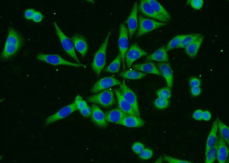 Immunofluorescent analysis of HeLa cells using Catalog No:110704(FOXO3A Antibody) at dilution of 1:25 and Alexa Fluor 488-congugated AffiniPure Goat Anti-Rabbit IgG(H+L)