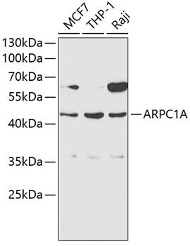 Western blot - ARPC1A Polyclonal Antibody 